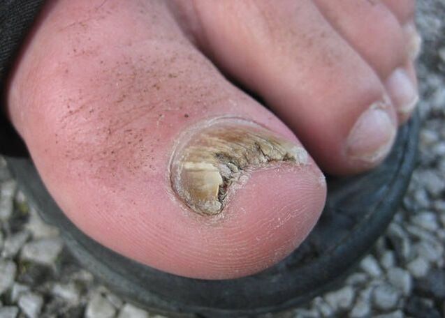 Το αποτέλεσμα της παραμέλησης