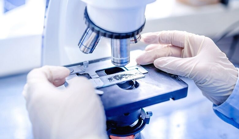 εργαστηριακή διάγνωση του μύκητα των νυχιών