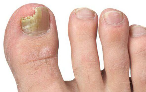 Διάφορες μορφές μύκητας