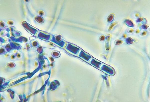 Μύκητας Trichophyton rubrum κάτω από μικροσκόπιο