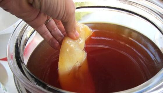 Kombucha για την αντιμετώπιση του μύκητα των νυχιών